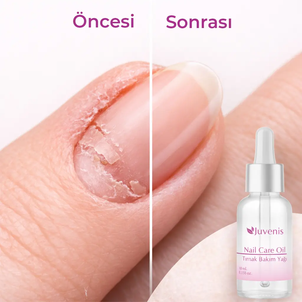 Clou Nails Oncesi Sonrasi (Tırnak Bakımı)