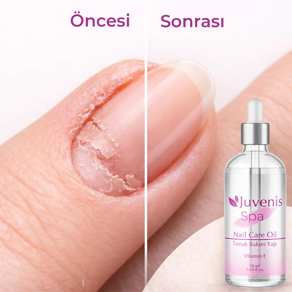 Clou Nails Oncesi Sonrasi (1) (Tırnak Bakımı)